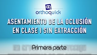 ASENTAMIENTO DE LA OCLUSIÓN EN CALSE I SIN EXTRACCIÓN PRIMERA PARTE [upl. by Shih]