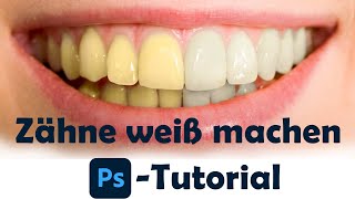 Zähne weiß machen bzw aufhellen  Photoshop Tutorial Deutsch [upl. by Nnylecoj]