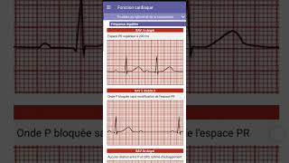 13 Le guide IADE les grandes fonctions [upl. by Lipson518]