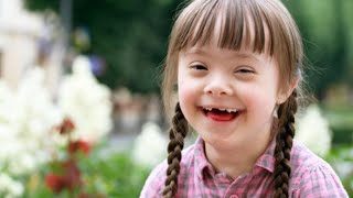 🔴 Down syndrome  episode  3  Genetic syndromes  STAFF for pediatric physical therapy [upl. by Aley]