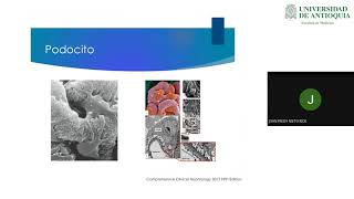 Glomerulonefritis Rápidamente Progresiva  Dr Mateo Aranzazu [upl. by Trevorr]