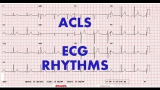 ACLS  ECG rhythm recognition amp management Part 1 [upl. by Emad]