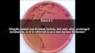 SorbitolMacConkey agar Top  8 Facts [upl. by Eiznikam]