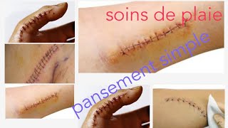 Soins infirmiers en chirurgie soins des plaies  pansement simple [upl. by Evania]