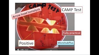 CAMP test CAMP Factor  CAMP Reaction  Microbiology Streptococcus agalactiae [upl. by Izawa]