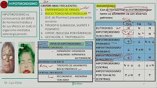 Endocrinología  Hipotiroidismo hashimoto [upl. by Ytrebil]