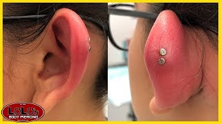 We Have Never Seen A Piercing This Swollen [upl. by Jozef]