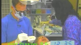 15 Minute Crown Procedure Part 2 [upl. by Peterman95]