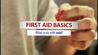 Basic first aid treatment for bleeding cuts [upl. by Aihsotal590]