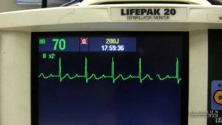 EKG Training Watching and Interpreting the Defibrillator Monitor [upl. by Schlosser233]