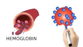 Hemoglobin A1c amp Diabetes [upl. by Barnebas]