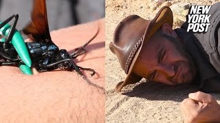 This terrifying wasps sting paralyzes this guys arm [upl. by Iggam800]