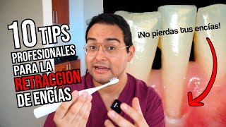 10 TIPS PROFESIONALES para DETENER y PREVENIR las ENCÍAS RETRAÍDAS  ¡NO PIERDAS TUS ENCÍAS [upl. by Nonnahc827]