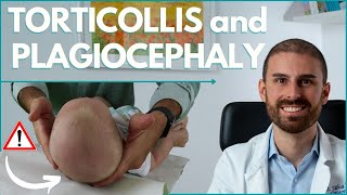 How to TREAT BABY TORTICOLLIS and PLAGIOCEPHALY  Dr Matteo Silva Pediatric Osteopath [upl. by Tabina]