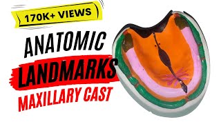 Lets Learn Anatomic landmarks in maxillary cast [upl. by Lovel]