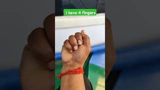 I Actually Have 4 Fingers [upl. by Asiulana]