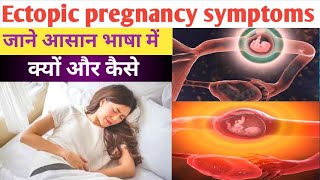 Ectopic Pregnancy  Symptoms of ectopic pregnancy  Ectopic pregnancy pain  DrNehaMehta medic [upl. by Ahsaret335]