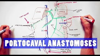 Portocaval Anastomoses  ANATOMY Tutorial [upl. by Nolan]