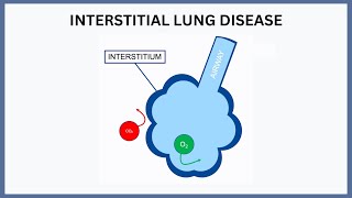 Interstitial Lung Disease Explained [upl. by Samy796]