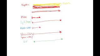 Nephrology 14b recap of nephroticnephritic spectrum SLE PSGN IgA vasculitis amyloidosis DM [upl. by Kobe]