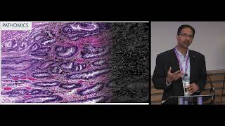 ECDP 2019  Computational Pathology as a Companion Diagnostic Implications for Precision Medicine [upl. by Nowd]