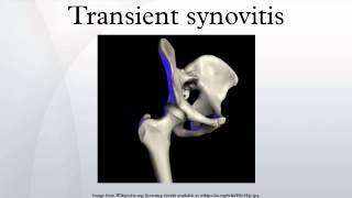 Transient synovitis [upl. by Euqinay892]