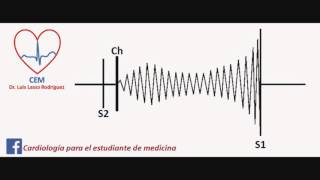 Soplo de la estenosis mitral [upl. by Drape]