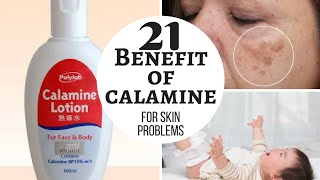 CALAMINE lotion  Lacto calamine lotion uses in detail side effects [upl. by Perretta596]