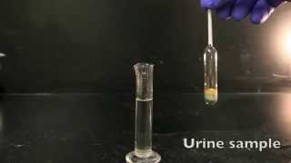 Using a Urinometer [upl. by Lledrev885]