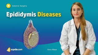 Epididymis Diseases  Surgery Video Lecture  Medical Online Education  VLearning™ [upl. by Karlyn]