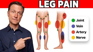 The 11 Causes of Leg Pain Revealed [upl. by Ibib951]