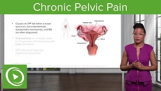 Chronic Pelvic Pain CPP Definition Diagnosis amp Management – Gynecology  Lecturio [upl. by Funch]