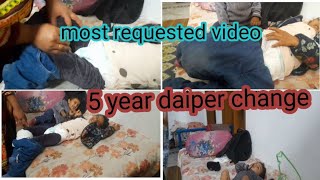 How to change 5 year old baby diper How to change baby diper  Changing of baby diper is very Easy [upl. by Aysab]