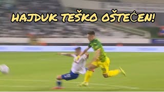 HAJDUK OŠTEĆEN PROTIV ISTRE [upl. by Ailime]