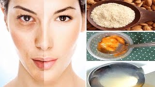 Melasma Cure  Home Remedies Hyperpigmentation Treatment at Home [upl. by Prudhoe204]