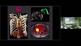 Basics of Radiology Modalities [upl. by Aneliram682]