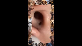 Blackhead Removal  12 Blackhead extraction  Ear blackhead  blackheads [upl. by Hesoj]