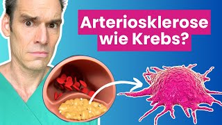 Arteriosklerose  eine tumorartige Erkrankung  Dr Waller erklärt [upl. by Vashtee]