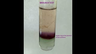 Molisch Testa group test for Carbohydrates [upl. by Longfellow]