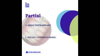 Types of Dental Implants [upl. by Nuawad]