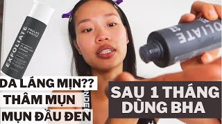 REVIEW BHA PAULAS CHOICE  CÓ THẬT SỰ HOT VÀ TỐT [upl. by Dnana]