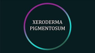 What is Xeroderma Pigmentosum XP [upl. by Alexandrina]