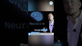 Neuralink Successfully Implants Brain Chip in Second Patient Says Musk [upl. by Dnana]