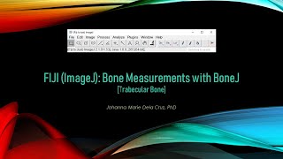 FIJI ImageJ Bone Analysis with BoneJ2 Trabecular Bone [upl. by Trebor740]