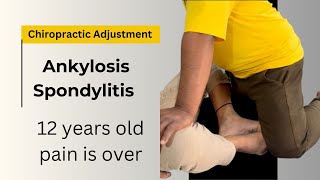 Ankylosing Spondylitis  Symptoms and Treatment Rheumatologist [upl. by Aray]