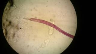 Adult female of Schistosoma haematobium [upl. by Ecyal]