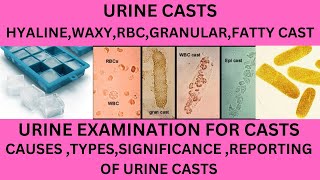 URINARY CASTS IN HINDI DIFFERENT TYPE OF CASTS IN THE URINECAUSES SIGNIFICANCE OF URINE CASTS [upl. by Alliscirp358]