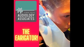 How to Clear Blockages in your Ear  The Earigator [upl. by Akinahc]