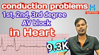 av block ecg  1st degree av block  2nd degree AV block  complete heart block  CHB ecg [upl. by Kursh]