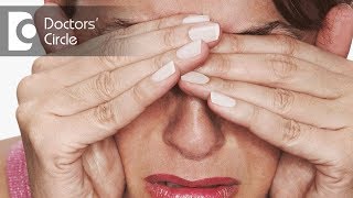 Can swelling of the eyes be related to Migraine Headache  Dr Elankumaran P [upl. by Lothario]